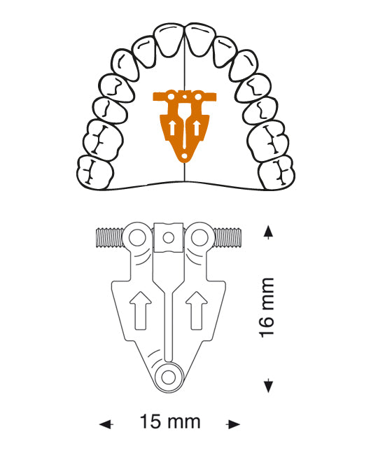 Fan-Type Screw