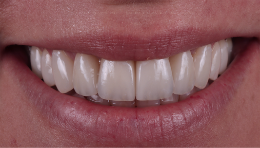 A Lockdown Story: How We Bounced Back Stronger.