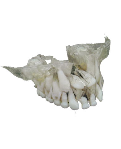 Anatomical Model with Supernumerary Teeth