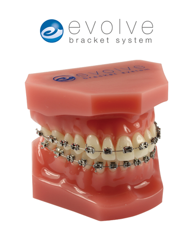 Consultation Model with Evolve™ Stainless Steel Brackets