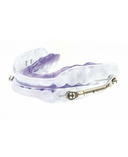 Mandibular Advancement Device (M.A.D) Telescopic Adjustable Advancer