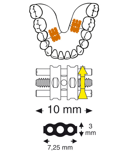 Micro Sectional Screw DB Lab Supplies
