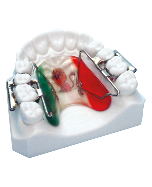 Rapid Molar Distalizer