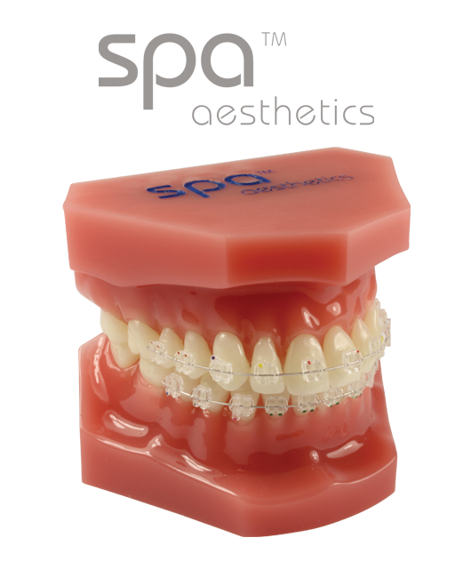 Consultation Model with Spa™ Brackets